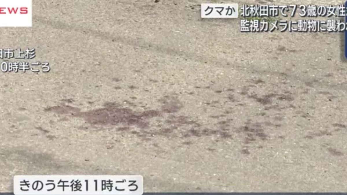 Japonya’da 73 yaşındaki kadına ayı saldırdı